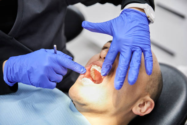 Best Emergency Wisdom Teeth Removal in Sweet Springs, MO