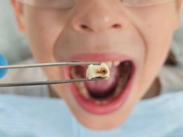Best Emergency Denture Repair in Sweet Springs, MO
